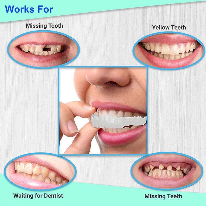 Snap On Braces | Special Teeth whitening Cover