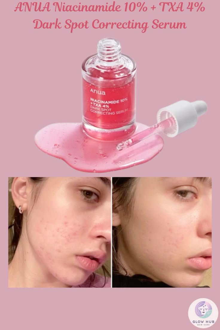 Anua Niacinamide 10% + TXA 4% Dark Spot Correcting Serum - 30ml