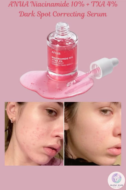 Anua Niacinamide 10% + TXA 4% Dark Spot Correcting Serum - 30ml