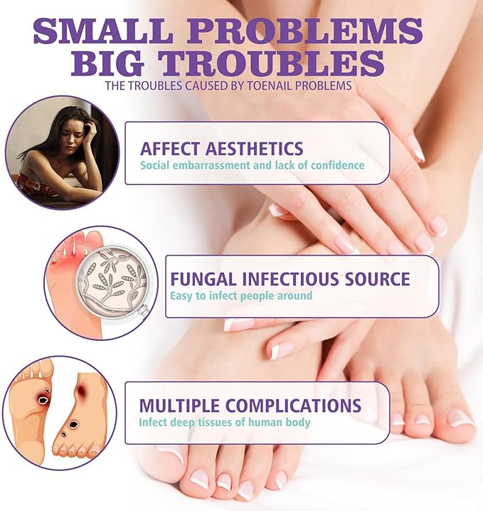 Nail healing & care Spray / رذاذ العناية بالأظافر وعلاجها